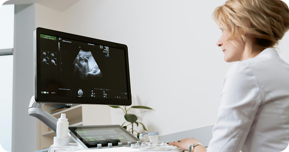 Farbduplex­sonographie <br> SOMNOtouch™ NIBP